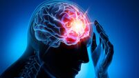 Headache-conceptual artwork-3d illustration