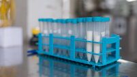 Samples in a laboratory of a dairy processing industry