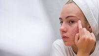 A teenage girl in a white towel on her head is looking at her face with problem skin in the mirror